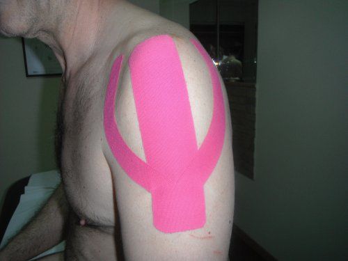 VENDAJE NEUROMUSCULAR O KINESIOTAPE